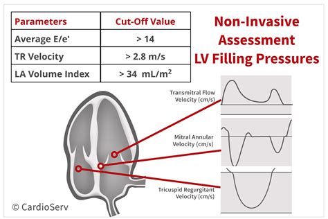 lvedp measurement